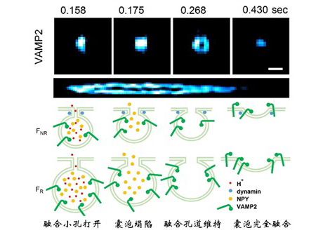 中國學(xué)者Nature Biotechnology：一種超靈敏結(jié)構(gòu)光超高分辨率顯微鏡