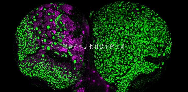 北大學(xué)者eLife發(fā)文：神經(jīng)祖細(xì)胞命運(yùn)鎖定，防止腦腫瘤發(fā)生新機(jī)制