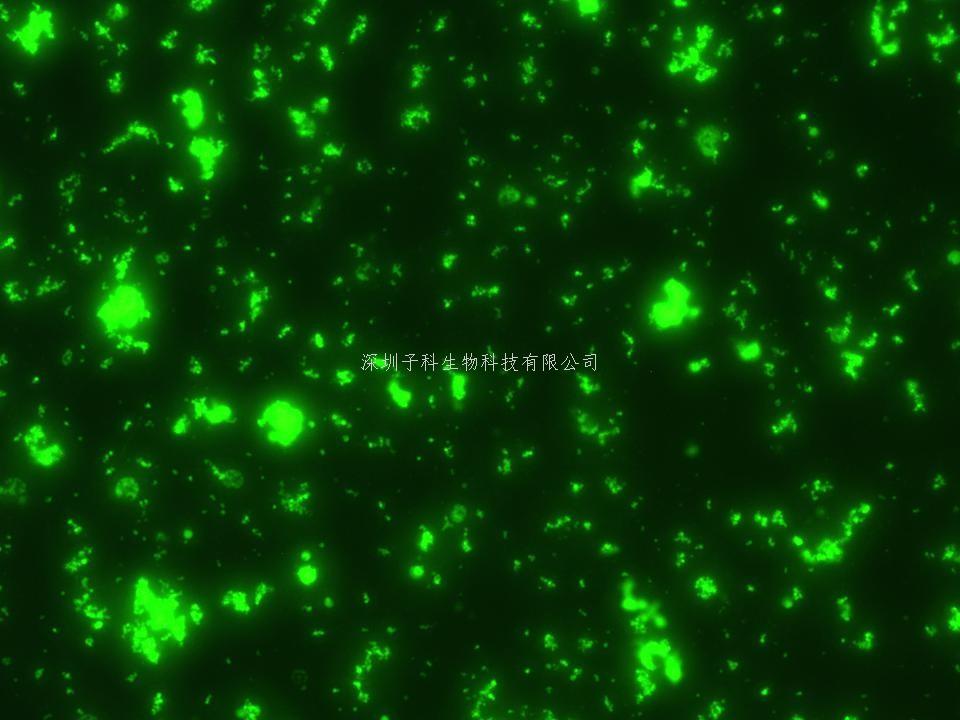 重慶大學(xué)Nature子刊發(fā)表耐藥研究首發(fā)性成果