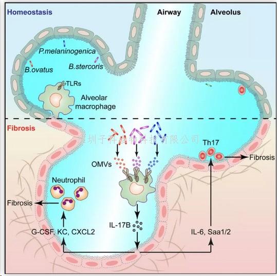 Immunity：錢(qián)友存團(tuán)隊(duì)發(fā)現(xiàn)肺纖維化疾病的分子機(jī)制