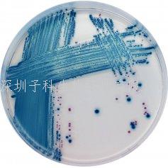 科馬嘉ESBL顯色培養(yǎng)基