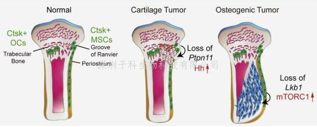 “少年殺手”骨肉瘤的新細胞起源以及STK11/LKB1對骨癌的發(fā)病影響