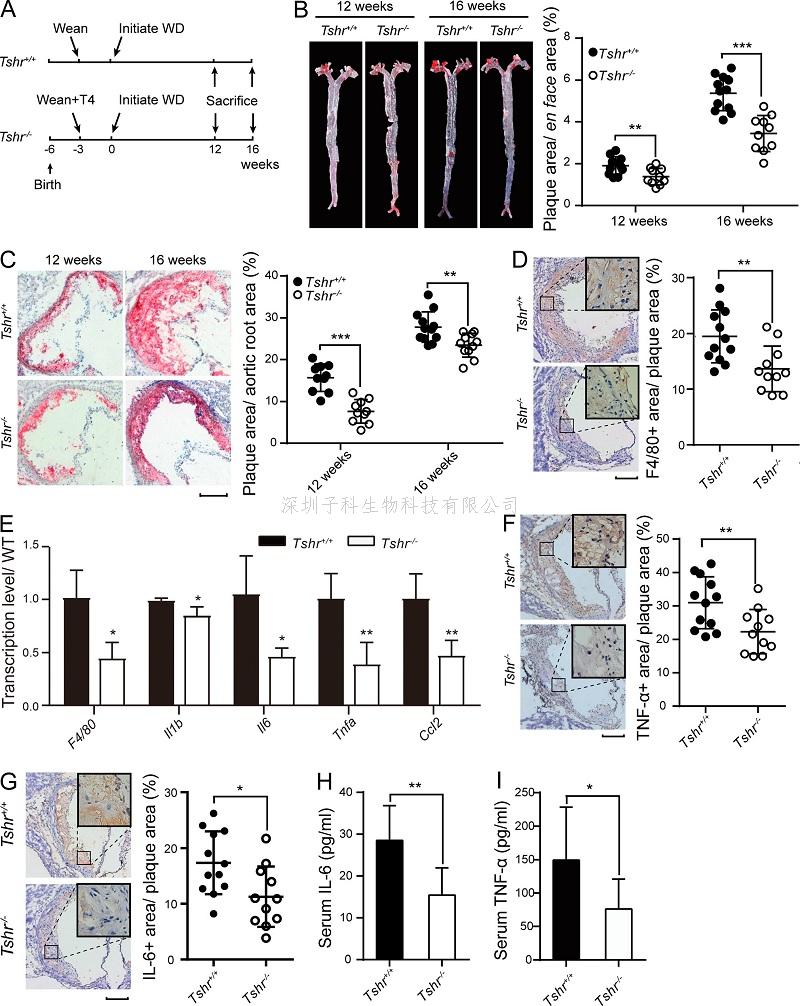 山大學(xué)者解析促甲狀腺激素如何促成動(dòng)脈粥樣硬化