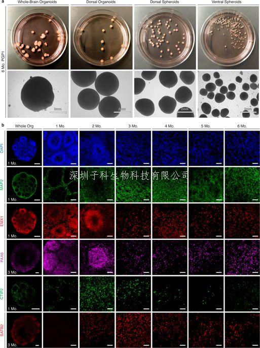 可復(fù)制的微型人腦3D模型開(kāi)辟神經(jīng)科學(xué)新領(lǐng)域