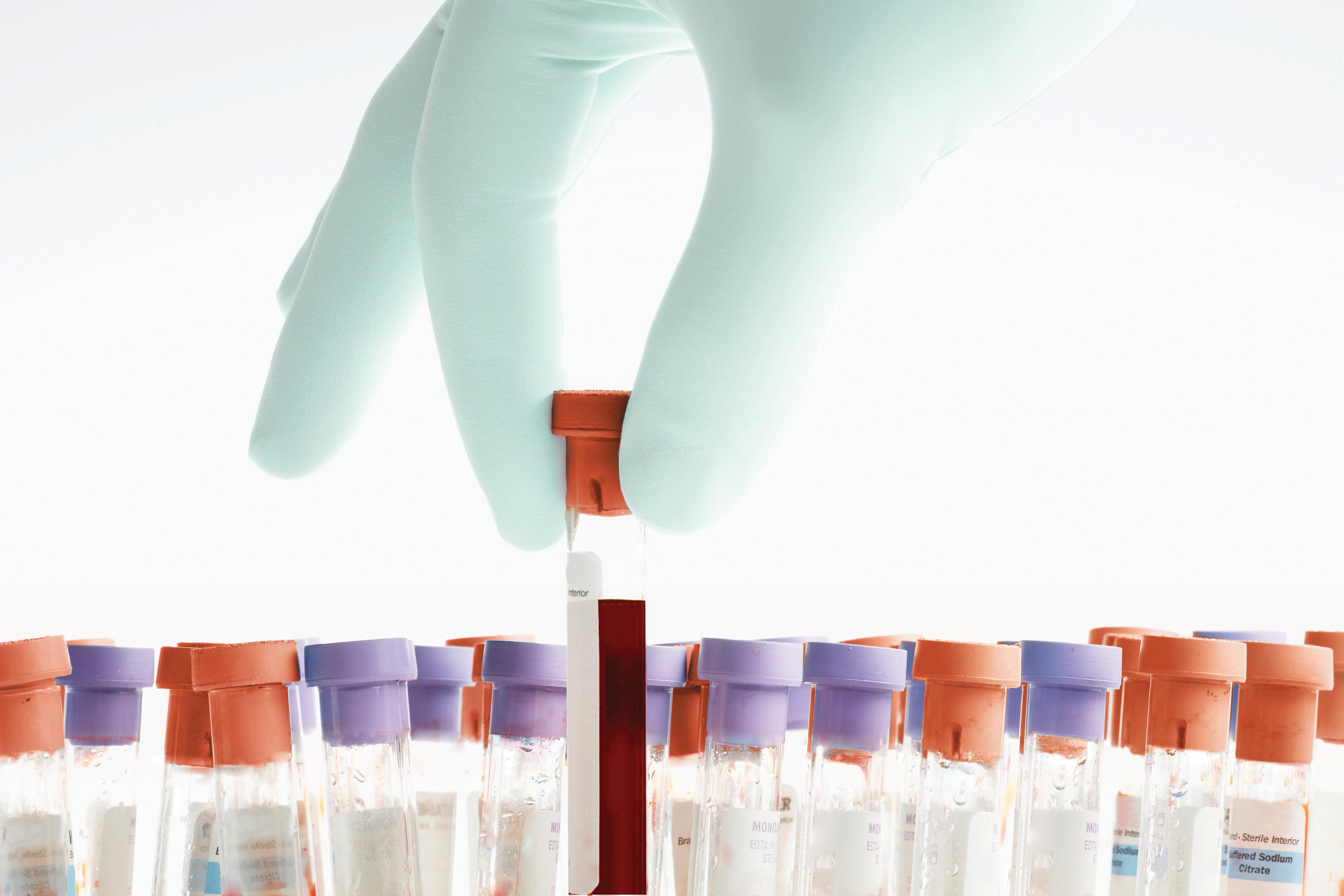 北大湯富酬教授等人最新Nature：利用單細(xì)胞轉(zhuǎn)錄組 和DNA甲基化組圖譜重構(gòu)人類胚胎著床過程