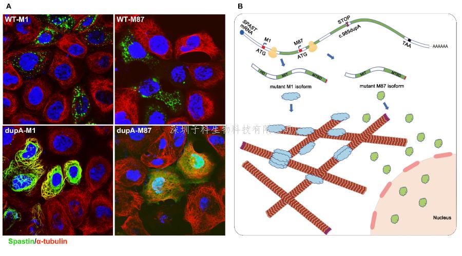 中科院腦智卓越中心發(fā)表關(guān)于遺傳性痙攣性截癱致病機制的研究成果