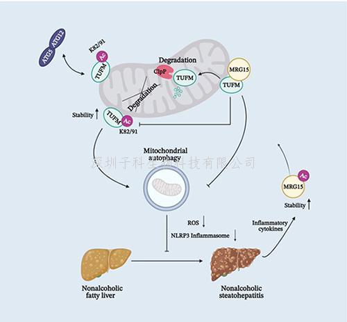 營養(yǎng)與健康所丁秋蓉課題組發(fā)現(xiàn)治療非酒精性脂肪肝炎的潛在新靶點