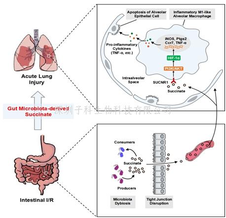 我國(guó)學(xué)者在腸源性肺損傷發(fā)生機(jī)制研究方面取得進(jìn)展