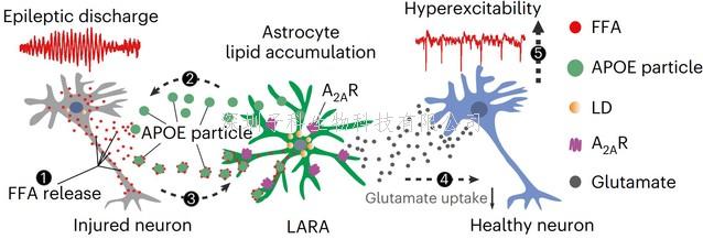 我院閆超/陳迪俊合作揭示脂堆積的星形膠質(zhì)細(xì)胞在癲癇病理中的作用