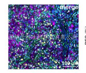 腫瘤醫(yī)院周光飚教授團(tuán)隊在腫瘤免疫療法療效預(yù)測上取得新進(jìn)展