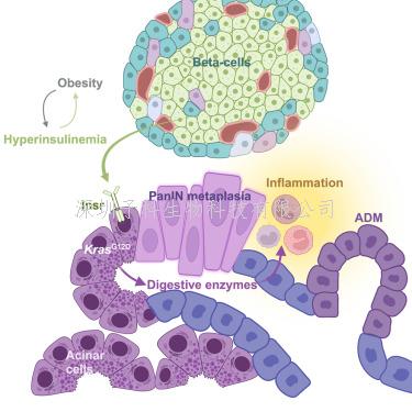 Cell子刊：首次指出胰腺腺泡細胞與胰島素水平升高有關(guān)