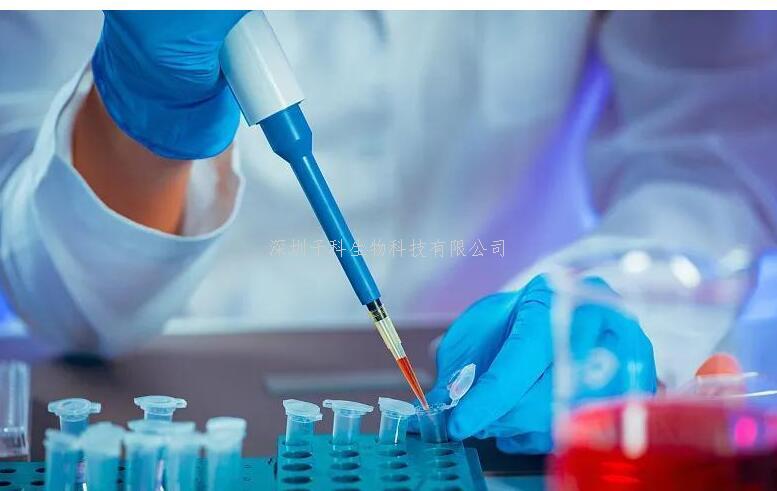 腦出血(Intracerebral hemorrhage, ICH)作為最致命的卒中類型，其致殘率高達80%，但現(xiàn)有治療手段對血腫清除后的神經(jīng)修復(fù)束手無策。尤其令人困擾的是，腦出血后白質(zhì)纖維的持續(xù)性損傷直接導(dǎo)致患者運動功能障礙，而傳統(tǒng)觀點認為巨噬細胞在腦損傷中主要扮演
